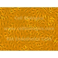ZDF Rat Diabetic Kidney Glomerular Endothelial Cells